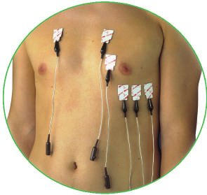 Electrodes 3M™ Red Dot™*