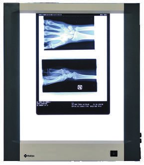 Négatoscope extra-plat